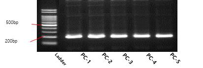 crAssphage 양성대조군 conventional PCR 결과