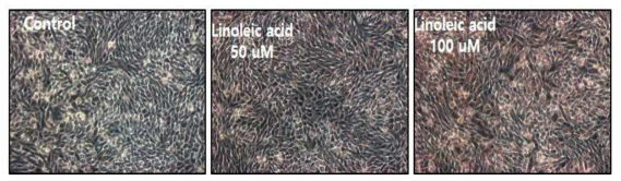 linoleic acid처리된 SZ95 세포의Oil-red-O 염색결과