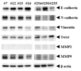 대장암 오가노이드의 EMT 및 MMP 계열 단백질 발현 확인