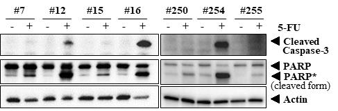 5-FU 처리에 따른 대장암 오가노이드의 세포사멸 단백질의 발현 확인