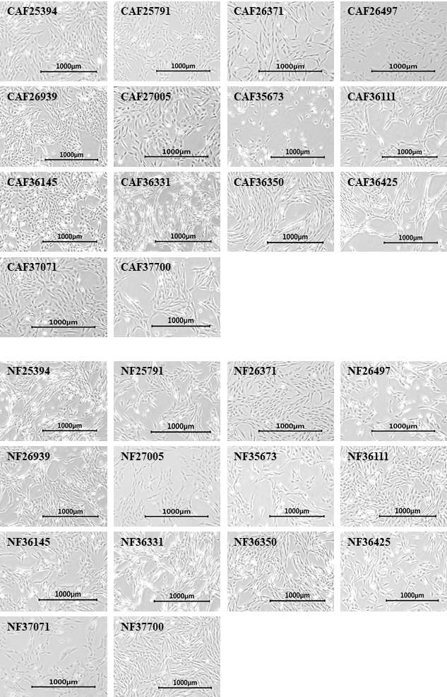 대장암 조직으로부터 구축된 NF 및 CAF 불멸화 세포주의 현미경 관찰 모습