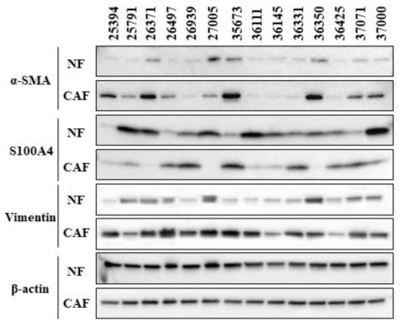 마커 단백질 발현을 통한 NF와 CAF의 단백질 발현 비교