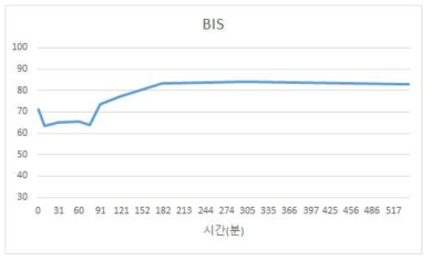 시간에 따른 BIS 값 변화