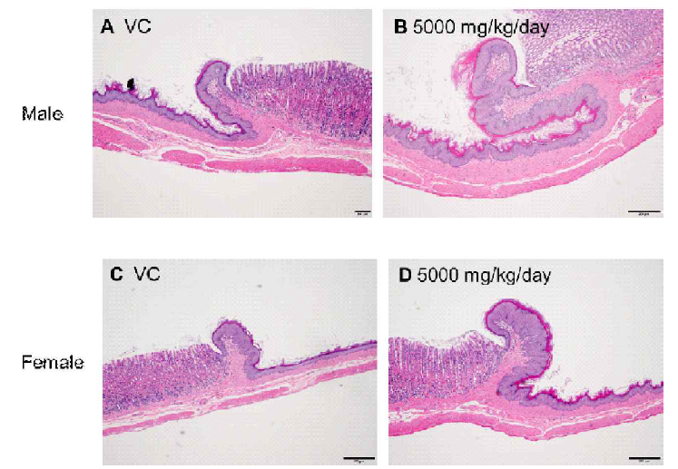 (A) Stomach from a male SD rat of control group (Main study). (B) Hyperplasia of squamous cells in stomach from a male 5000 mg/kg/day treatment group (Main study). (C) Stomach from a female SD rat of control group (Main study). (D) Hyperplasia of squamous cells in stomach from a female 5000 mg/kg/day treatment group (Main study). Scale bar, 200 μm; H&E