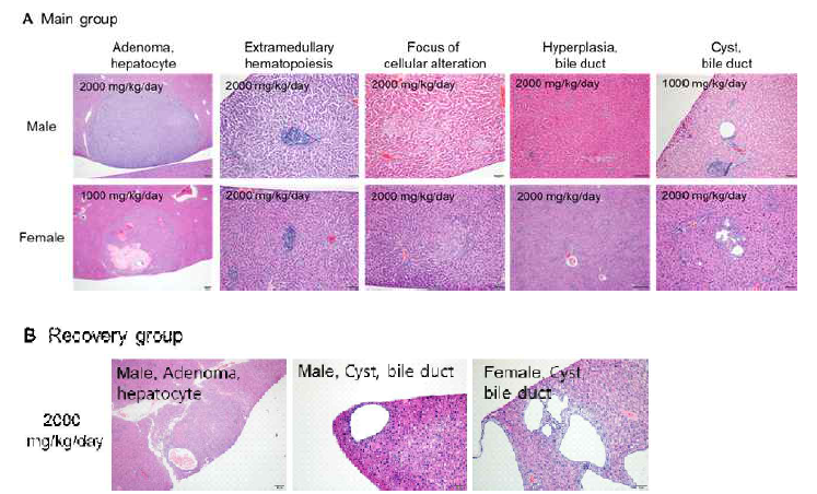 (A) Representative histopathology of liver from SD rat of 1000 or 2000 mg/kg/day treatment group (main group), (B) Representative histopathology of liver from SD rats of 2000 mg/kg/day treatment group (recovery group), Scale bar, 50 or 200 μm; H&E