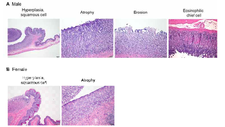 (A) Reprsentative histopathology of stomach from male SD rat of 2000 mg/kg/day treatment group (main group), (B) Representative histopathology of stomach from female SD rat of 2000 mg/kg/day treatment group (main group), Scale bar, 50, 100 or 200 μm; H&E