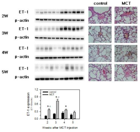 MCT 투여에 의한 폐에서의 endothelin-1 (ET-1) 발현 변화