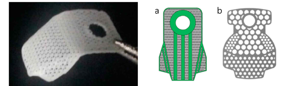 3D 프린팅으로 제작된 PCL/PLGA/TCP 치주조직재생유도재의 예 (왼쪽 – 실제 제작 샘플; 오른쪽 – 차폐막 디자인[Shim 등(2015) Polymer 7(10):2061-2077]