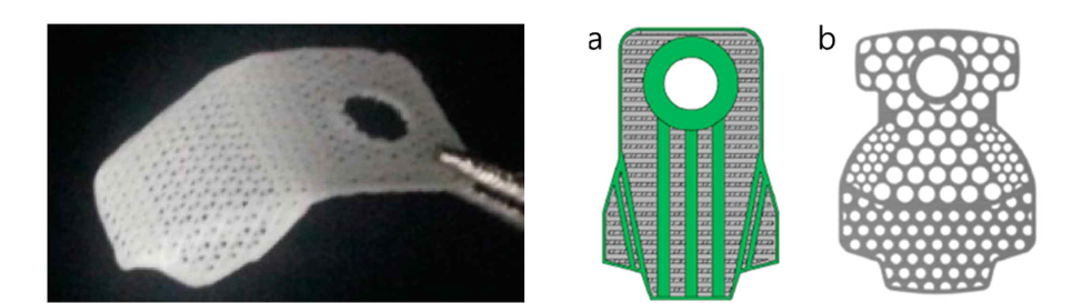 3D 프린팅으로 제작된 PCL/PLGA/TCP 치주조직재생유도재의 예(왼쪽 – 실제 제작 샘플; 오른쪽 – 차폐막 디자인[Shim 등(2015) Polymer 7(10):2061-2077]