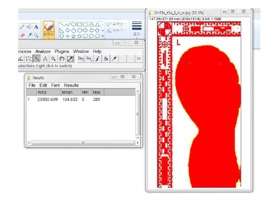 ImageJ를 통한 족적 넓이 확인