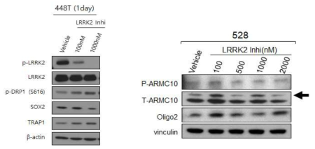 뇌종양 환자 줄기능세포주에서 LRRK2 저해 후 ARMC10과 줄기능에 관련된 결과