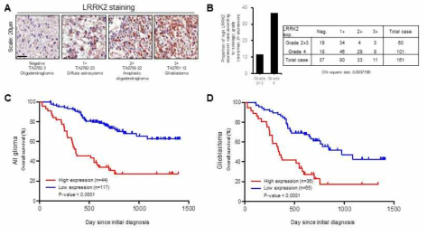 뇌종양 환자에서의 LRRK2 발현 분포 조사를 위해 161명의 뇌종양 환자조직에서 Immunohistochemistry를 통해 확인 (A). 염색결과 약 25%의 환자는 2+ 이상으로 매우 높은 LRRK2 발현이 확인됨 (B). 특히 LRRK2의 발현이 높은 All glioma (C) 와 Glioblastoma (D) 환자 모두에서 예후가 좋지 않음을 확인함