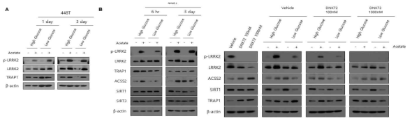 기존 확립된 뇌종양 환자 세포주에서 Acetate가 LRRK2의 활성을 조절함. Low Glucose와 High Glucose 조건에서 Acetate의 LRRK2 활성 조절 검증 (A). 뇌종양 세포주에서 Acetate를 사용하도록 하는 Reprogramming 조절 인자인 ACSS2, SIRT1, SIRT3의 발현 정도를 LRRK2의 발현 양상과 비교 검증함