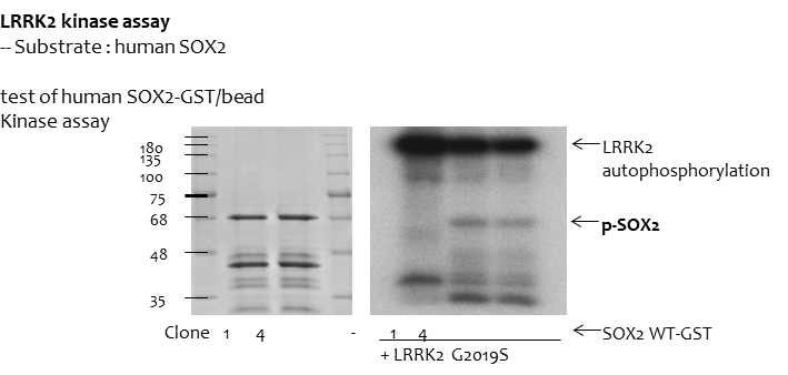 Kinase assay를 통한 LRRK2가 조절하는 Human Sox2의 활성을 확인함