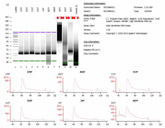 갑상선정상/암조직 transposon binding peak