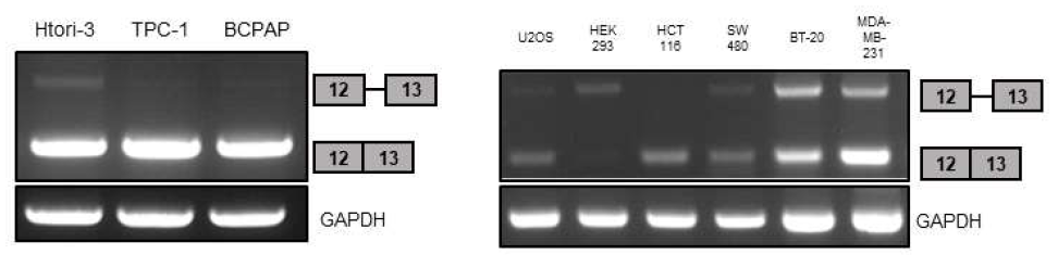 갑상선 세포주인 Htori-3, TPC-1, BCPAP, 그리고 U2OS(osteosarcoma), HEK293(Human embryonic kidney), HCT116(colon cancer), SW480(colon cancer), BT-20(breast cancer), MDA-MB-231(breast cancer)와 같은 다양한 세포주의 RNA를 template로 사용해 TSP-1 primer로 RT-PCR을 진행하였다