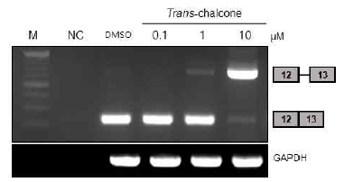 갑상선 암 세포주인 BCPAP에 phytochemical 중 하나인 Trans-chalcone을 여러 dose로 처리하여 RNA를 추출하였고, 이를 template로 사용해 TSP-1 primer로 RT-PCR을 진행하였다