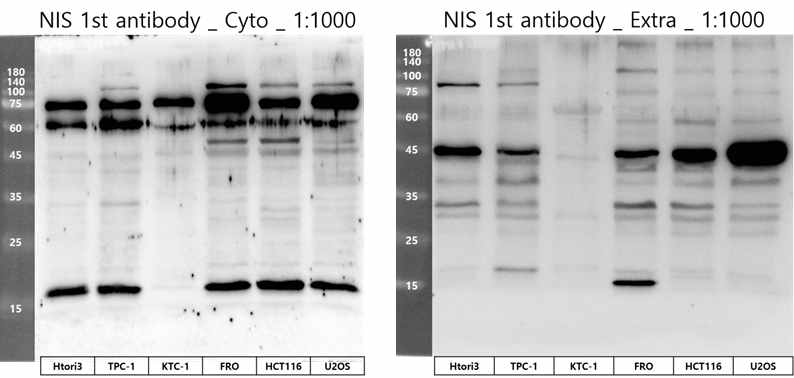 Western blot from different cell lysates. Newly synthesized antibody was used to detect NIS