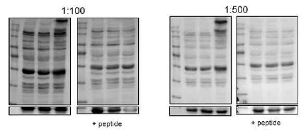 BCPAP 세포주에 EV, TSP1W(WT), TSP1V(V)를 transfection한 cell lysate로 western blot을 진행하였다. TSP1V 항체를 1:100, 1:500 두 가지 농도로 희석하였고 두 그룹으로 나눠 왼쪽에는 항체만 희석한 것을 오른쪽에는 항체를 제작할 때 사용했던 peptide와 섞어준 것을 처리하여 detection하였다