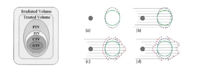 ICRU-62에서 정의한 표적부위의 개념도(좌) 및 양성자 빔 방향에 따른 PTV 개념도 (우)