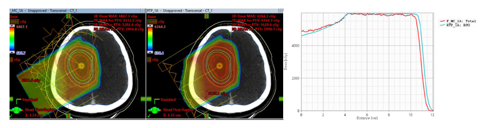 Brain 케이스에 대한 몬테칼로 전산모사(좌) 및 치료계획시스템(우)의 양성자 비정 비교