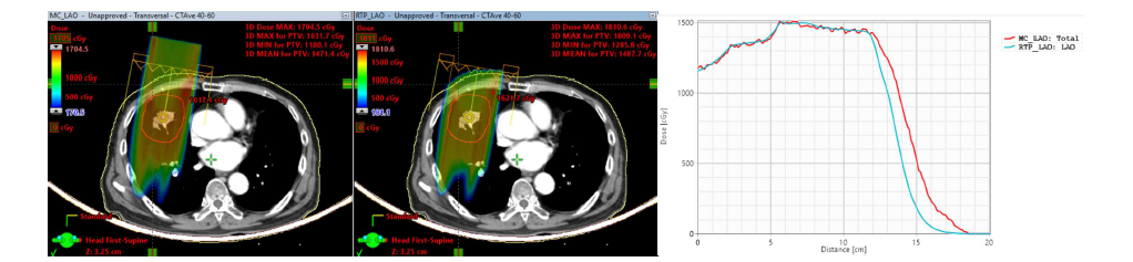 Lung 케이스에 대한 몬테칼로 전산모사(좌) 및 치료계획시스템(우)의 양성자 비정 비교