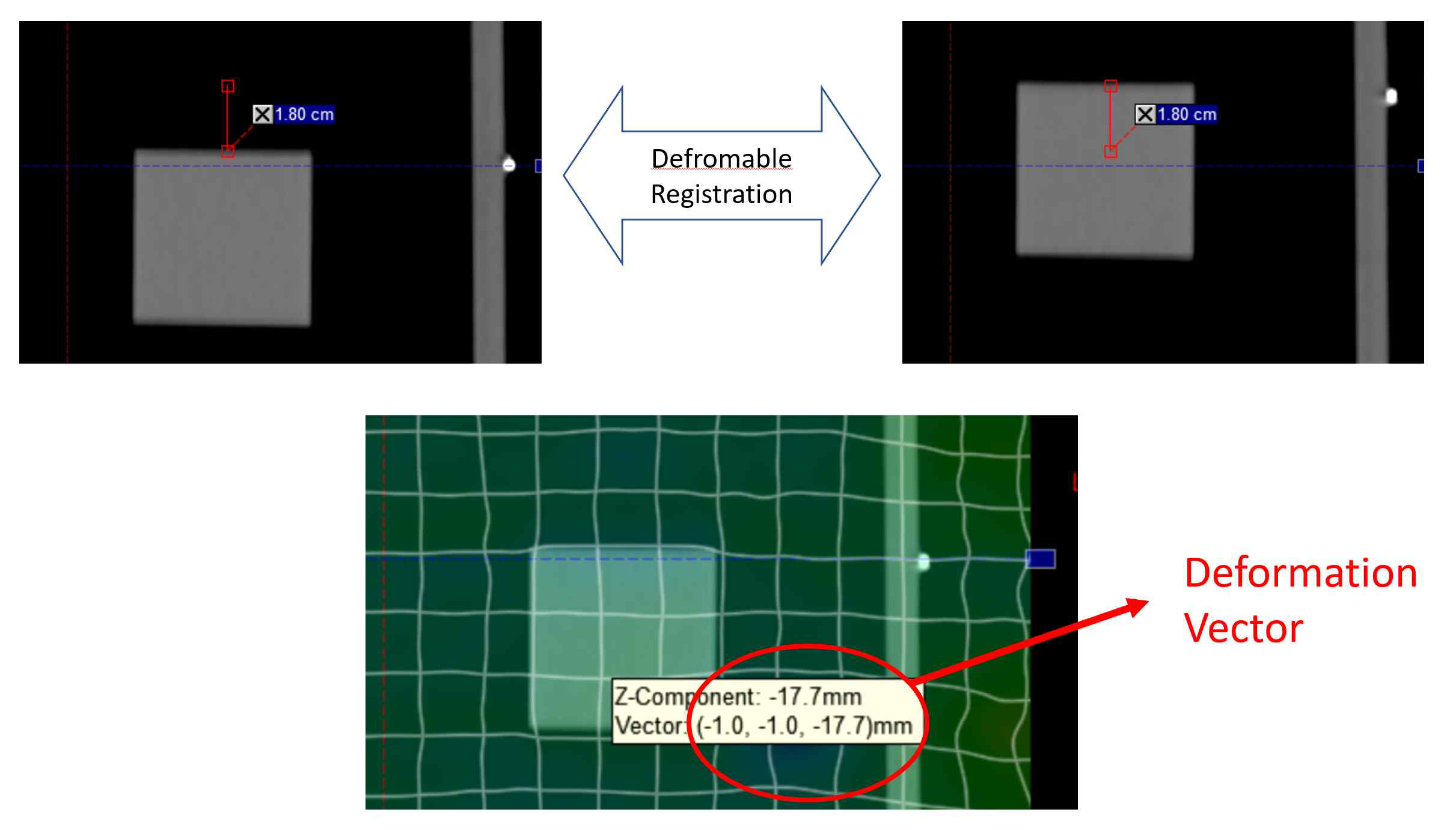 가변영상일치법(Deformable Image Registration, DIR)의 벡터필드의 가시화 영상