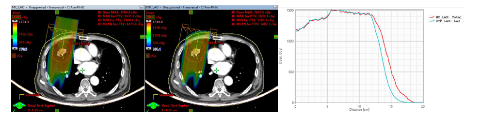 Lung 케이스에 대한 몬테칼로 전산모사(좌) 및 치료계획시스템(우)의 양성자 비정 비교