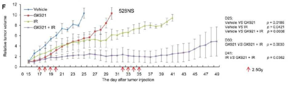 방사선 치료와 TGase 2 억제제 병용 요법. 528NS GBM 세포주를 사용 하여 tumor를 만들고, 방사선 조사 (IR), TGase 2 inhibitor (GK921), combination (purple) 의 그룹으로 실험을 한 결과 병용 요법에서 탁월한 효능을 보여줌
