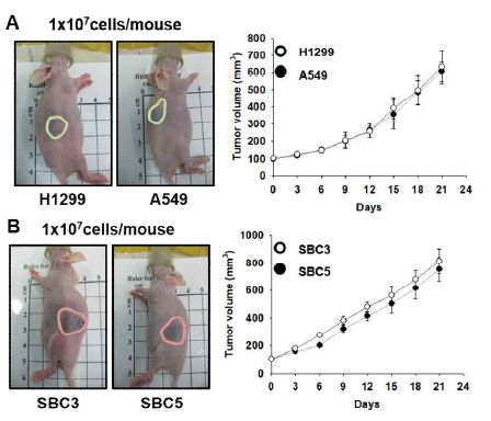 Tumor xenogrart with SCLC and NSCLC