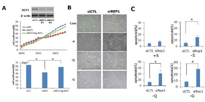췌장암 세포 성장 및 영양 결핍조건에서 세포 생존에 REP1의 중요한 역할