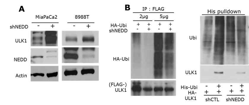 NEDD4L에 의한 ULK1의 안정화와 Ubiquitination