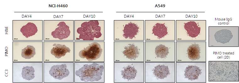 Histological characterization of tumor spheroids