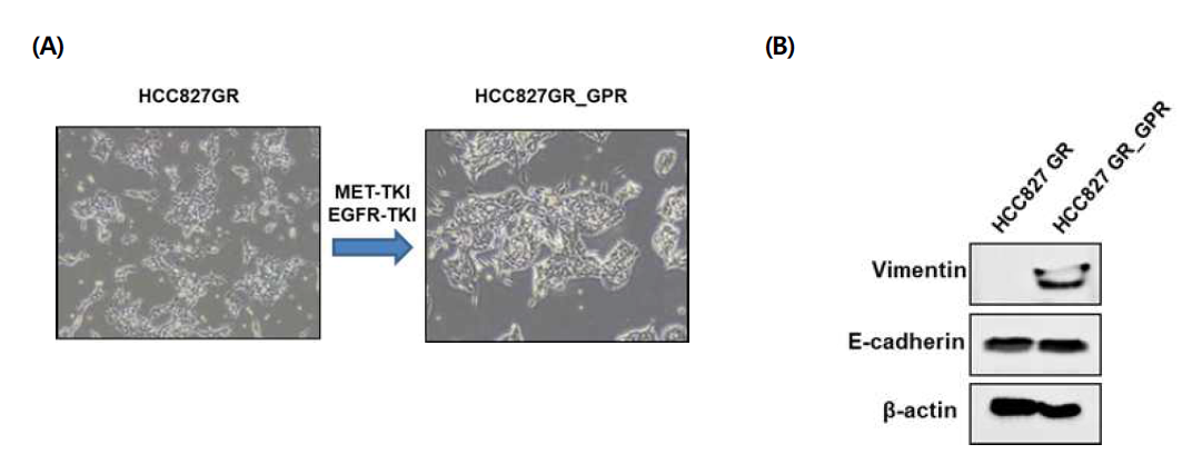 (A) MET 표적 항암제 내성 세포주 HCC827GR_GPR 그림 (B) Western blotting assay는 HCC827GR_GPR내성 세포주에서 EMT 과정이 발생함을 보여줌