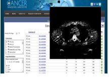 미국, TCIA(The Cancer Imaging Archive)