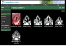 일본, Cancer Image Reference Database