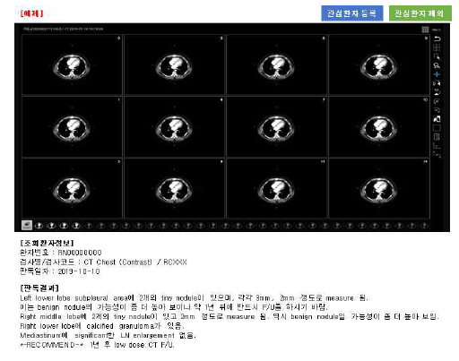 영상검색 플랫폼 내 검색결과 조회화면(예시)