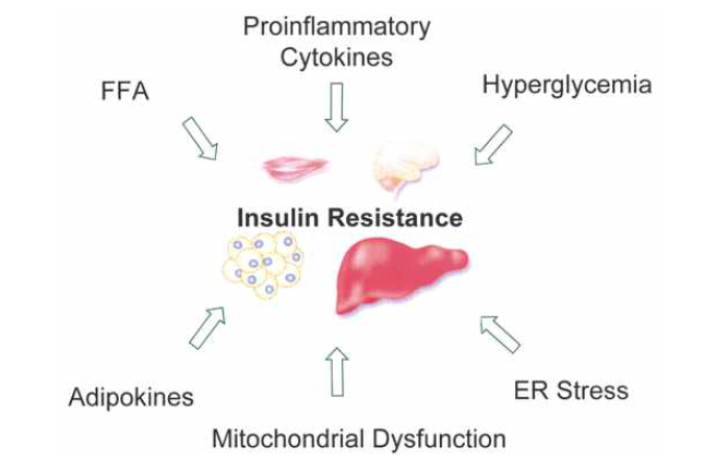 인슐린 저항성 유발 요인