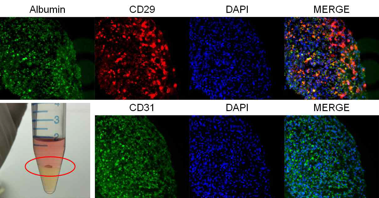 당뇨 유도 간 오가노이드 내의 세포 분포. Albumin (간세포), CD29 (중간엽줄기세포),DAPI (핵 염색), CD31 (혈관내피세포)
