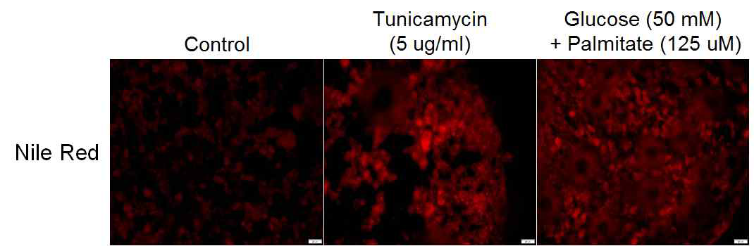 Tunicamycin 및 glucose+palmitate 처리에 의한 질환 표현형 증가 (지방 염색 증가)