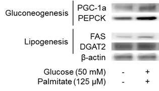 Gluconeogenesis 와 lipogenesis markers 단백질 발현이 증가된 지방간 유도 모델