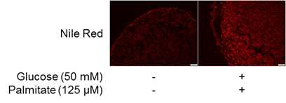 Glucose 및 palmitate 처리를 통해 형성된 지방간 오가노이드 모델에서 중성지방 축적 (nile red 염색)