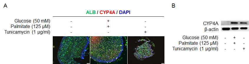 지방간 유도 오가노이드에서 CYP4A 단백질 발현 증가 (A) Immunocytochemistry (B) Western blot