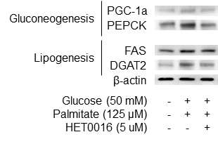 단백질 수준에서 HET0016에 의한 gluconeogenesis 및 lipogenesis marker 발현 감소