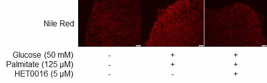 HET0016에 의한 중성지방 축적 감소 확인 (nile red 염색)