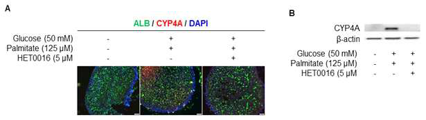 지방간 오가노이드에서 증가된 CYP4A 단백질 발현이 HET0016에 의해 감소됨 (A) Immunocytochemistry (B) Western blot