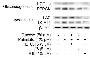 단백질 수준에서 CYP4A in silico 저해제 #8, #18에 의한 gluconeogenesis 및 lipogenesis marker 발현 감소