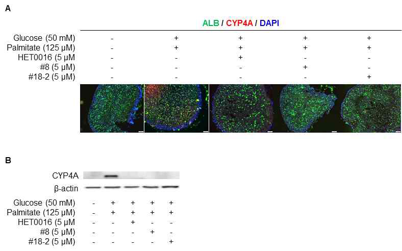 지방간 오가노이드에서 CYP4A in silico 저해제 처리에 의한 CYP4A protein expression 비교 (A) Immunocytochemistry (B) Western blot