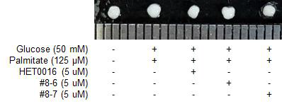 지방간 유도, HET0016, #8-6 및 #8-7의 처리에 따른 오가노이드의 외형 및 크기 비교