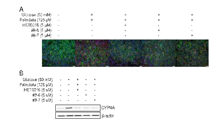 #8-6 및 #8-7의 처리에 따른 CYP4A의 발현 감소 (A) Immunocytochemistry (B) Western blot